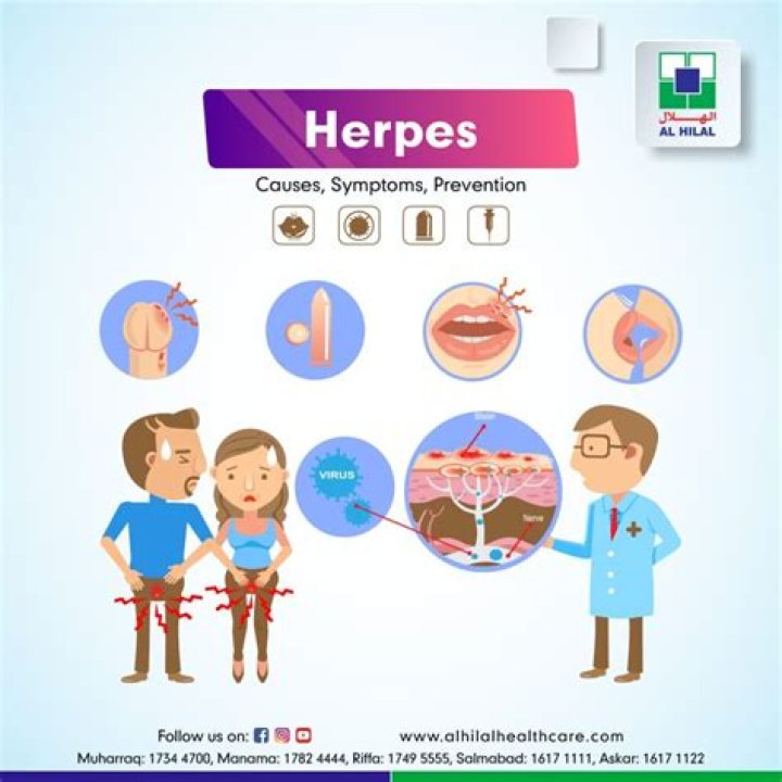 Usher and Herpes: Understanding the Facts and Implications
